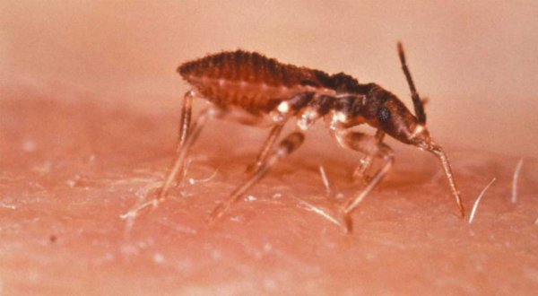 Casos de mal de Chagas en estado no son graves