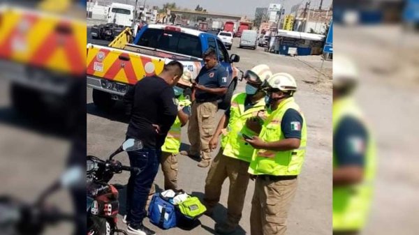 Le disparan en la cara durante un intento de robo en Silao