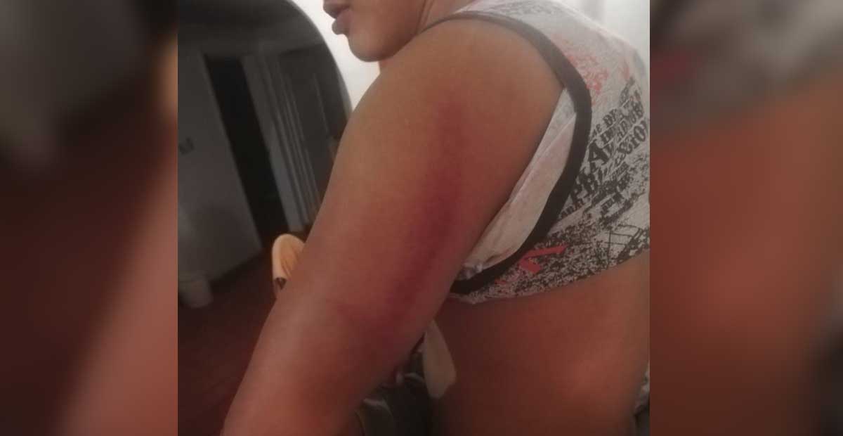 Denuncia capitalino haber sido golpeado y asaltado por policías