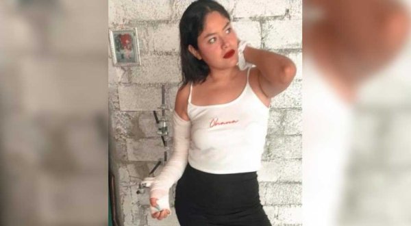 Una máquina le arrancó el brazo y el IMSS logró devolvérselo