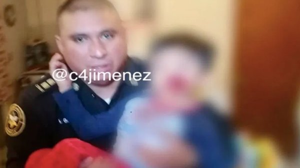 Un perro pitbull muerde la cara de un niño de cinco años