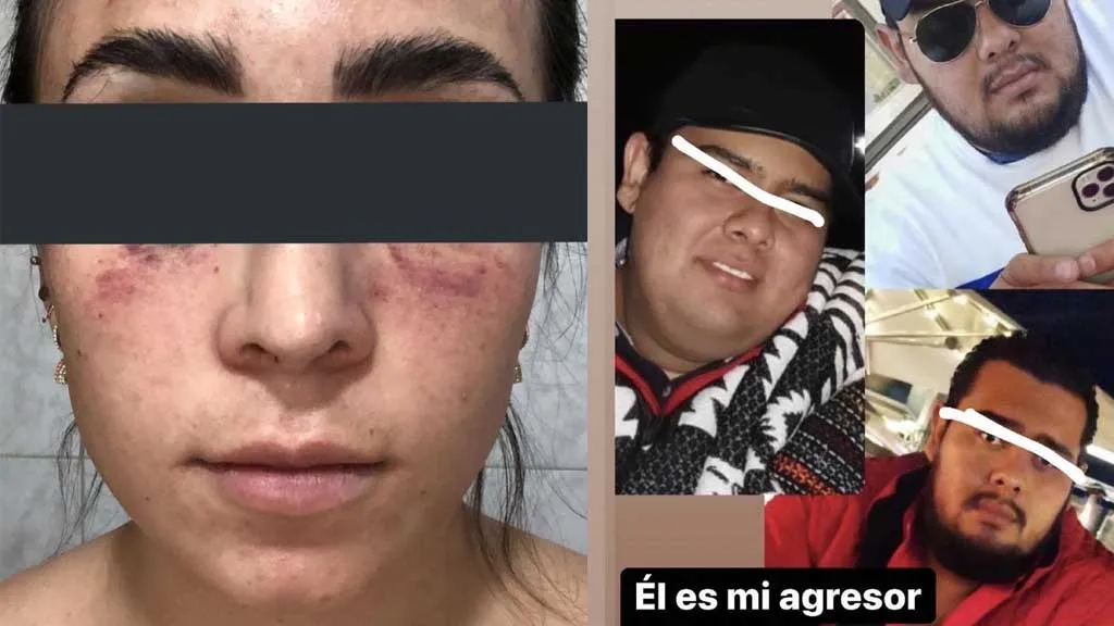 Mujer embarazada denuncia a hermano de candidata por agresión