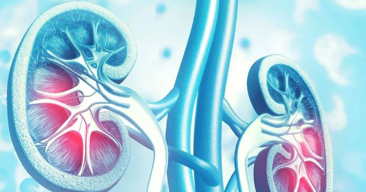 Investiga Guanajuato al menos 10 casos de enfermedad renal ligada a atención médica