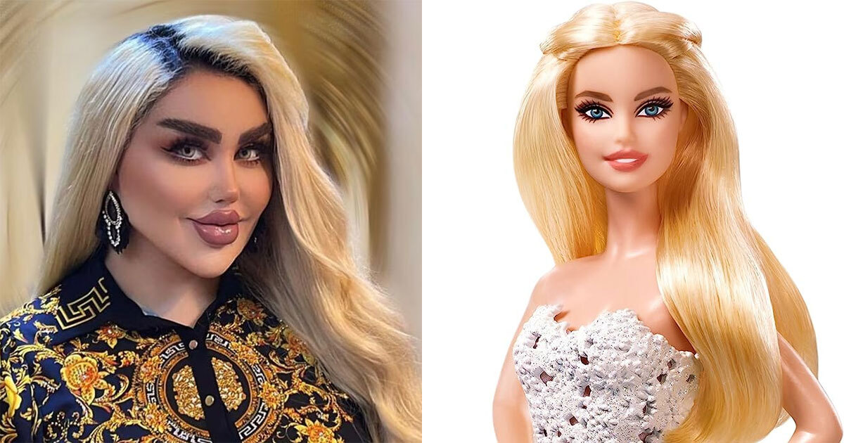 Influencer iraquí se somete a 43 cirugías estéticas para ser Barbie; el resultado no fue el esperado