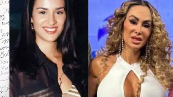 Los cambios de Ninel Conde, ¿cuántas veces se ha operado y cómo luce en 2023?