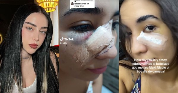 Video: Acusan a Nikki Nicole de agresión contra fan; la golpeó con una botella en la cara