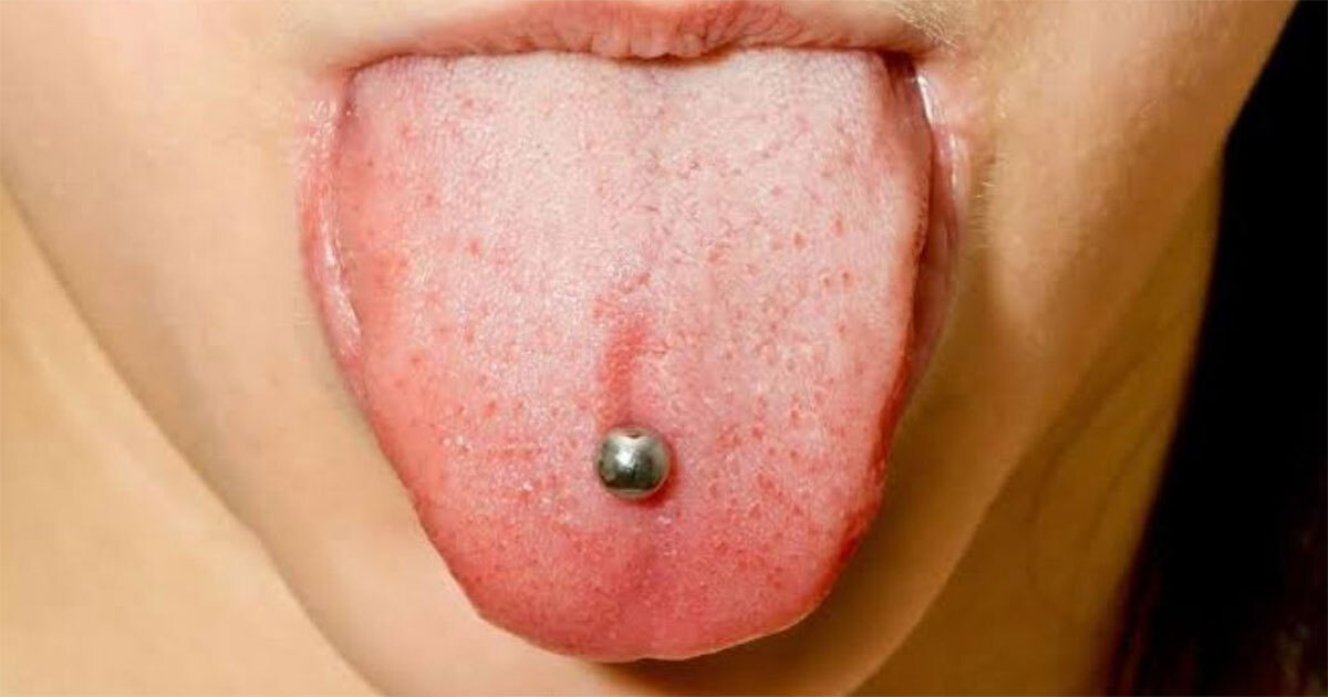 Advierten por aumento de infecciones por piercings en Salamanca; se los ponen en el tianguis