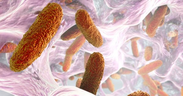 ¿Qué es la bacteria klebsiella oxytoca que tanto preocupa a Guanajuato? Así puedes protegerte 